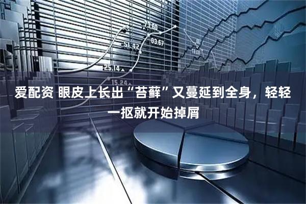 爱配资 眼皮上长出“苔藓”又蔓延到全身，轻轻一抠就开始掉屑